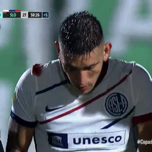Centurión, el único lesionado tras la derrota